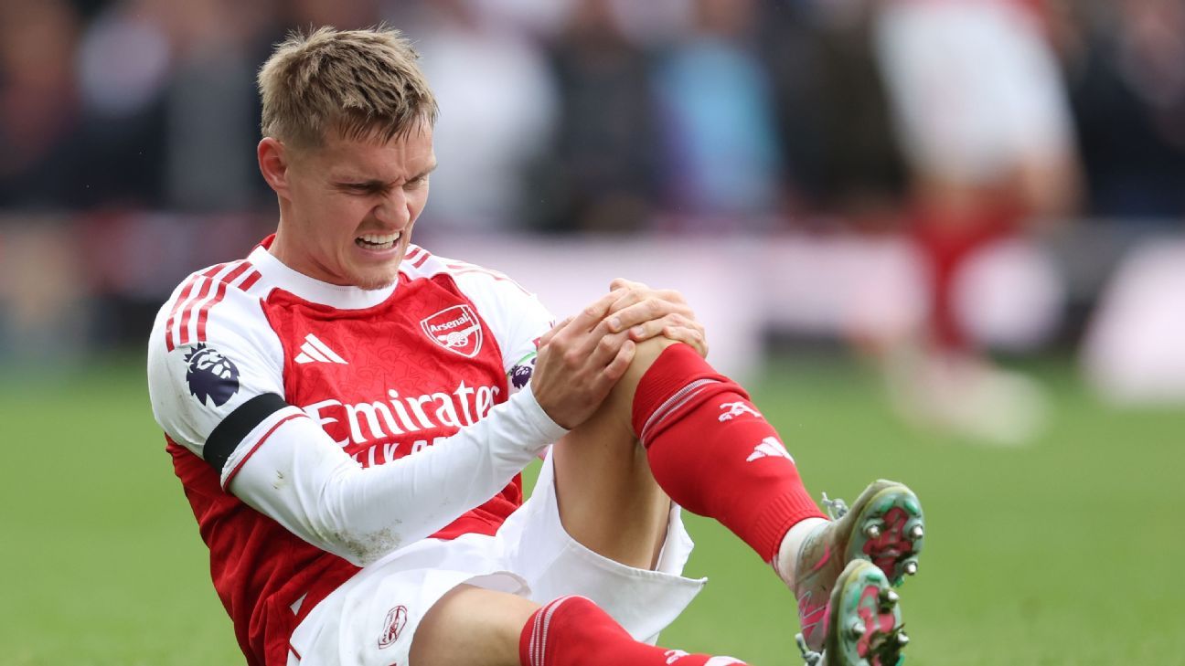 Arteta comemora 300º jogo com vitória, mas se preocupa com nova lesão de Ødegaard - Imagem do artigo